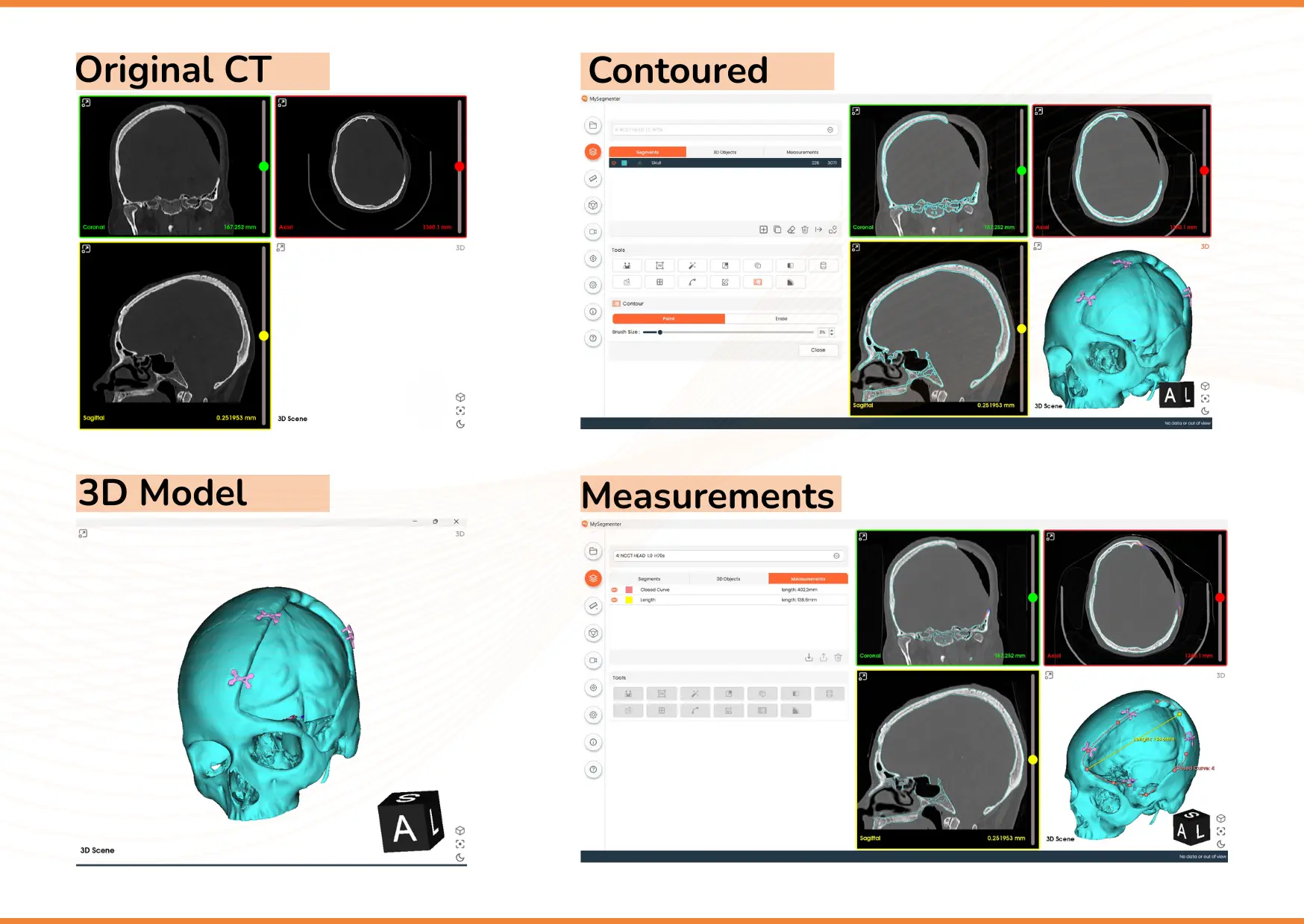 MySegmenter Workflow - Import, Segment, Visualize, Export