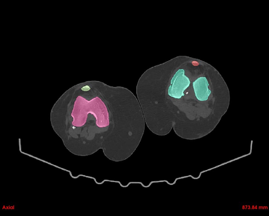 Axial View with Segmentation