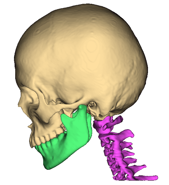 Head & Neck CT scan preview
