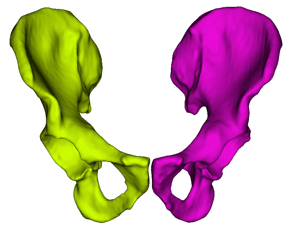 Pelvis CT scan preview