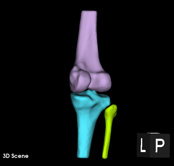 Final 3D Anatomical Model